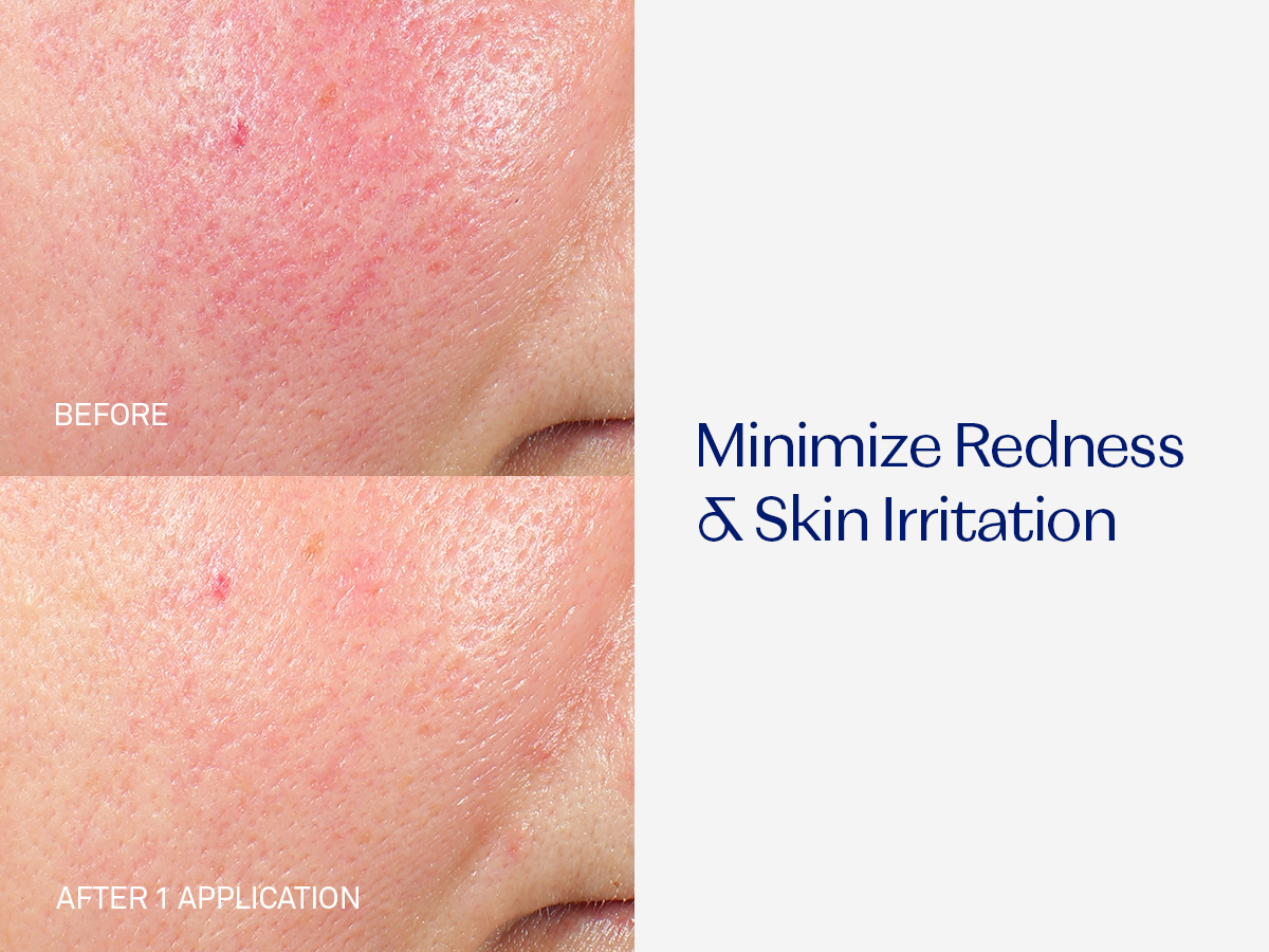 RescueMD DNA Repair Complex Scar Treatment Serum, Redness and Skin Damage Solution, 30mL