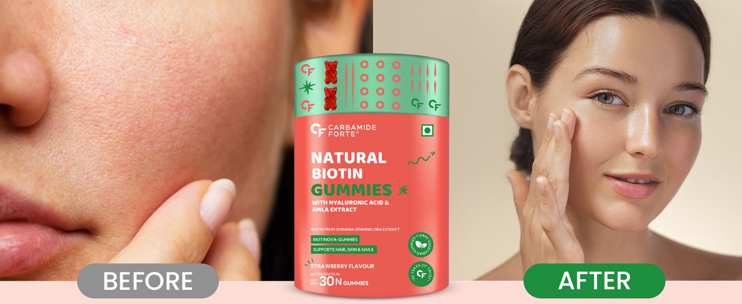 Carbamide Forte Biotin Gummies for Hair Growth | Supplement for Men & Women | - 30 Veg Strawberry - Flavored Gummies