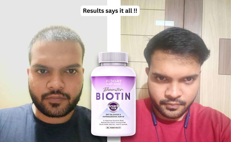 Hair Growth Biotin Tablets | Biotin Tablets with Multivitamin Ingredients