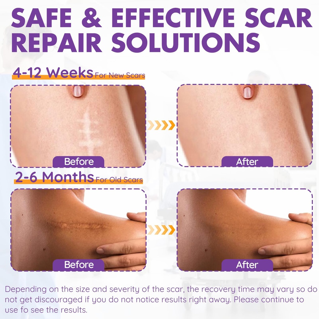 silicone-scar-sheets-silicone-scar-tape--5.jpg