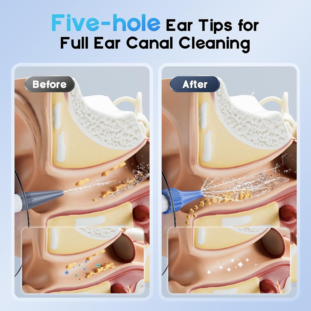 ear-wax-removal-electric-ear-cleaning-ki-4.jpg