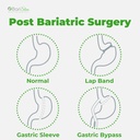 barislim-complete-chewable-bariatric-mul-4.jpg