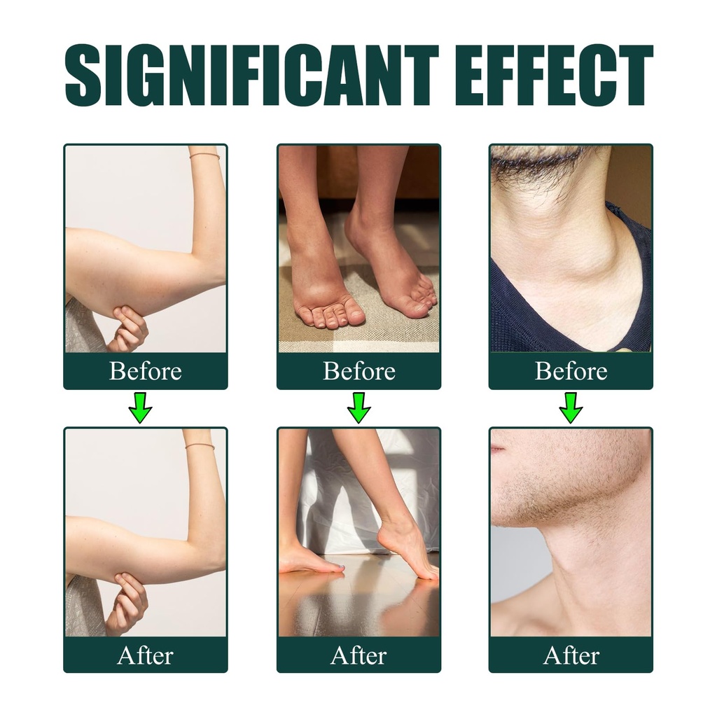 lymphatic-drainage-drops-lymphatic-suppo-4.jpg