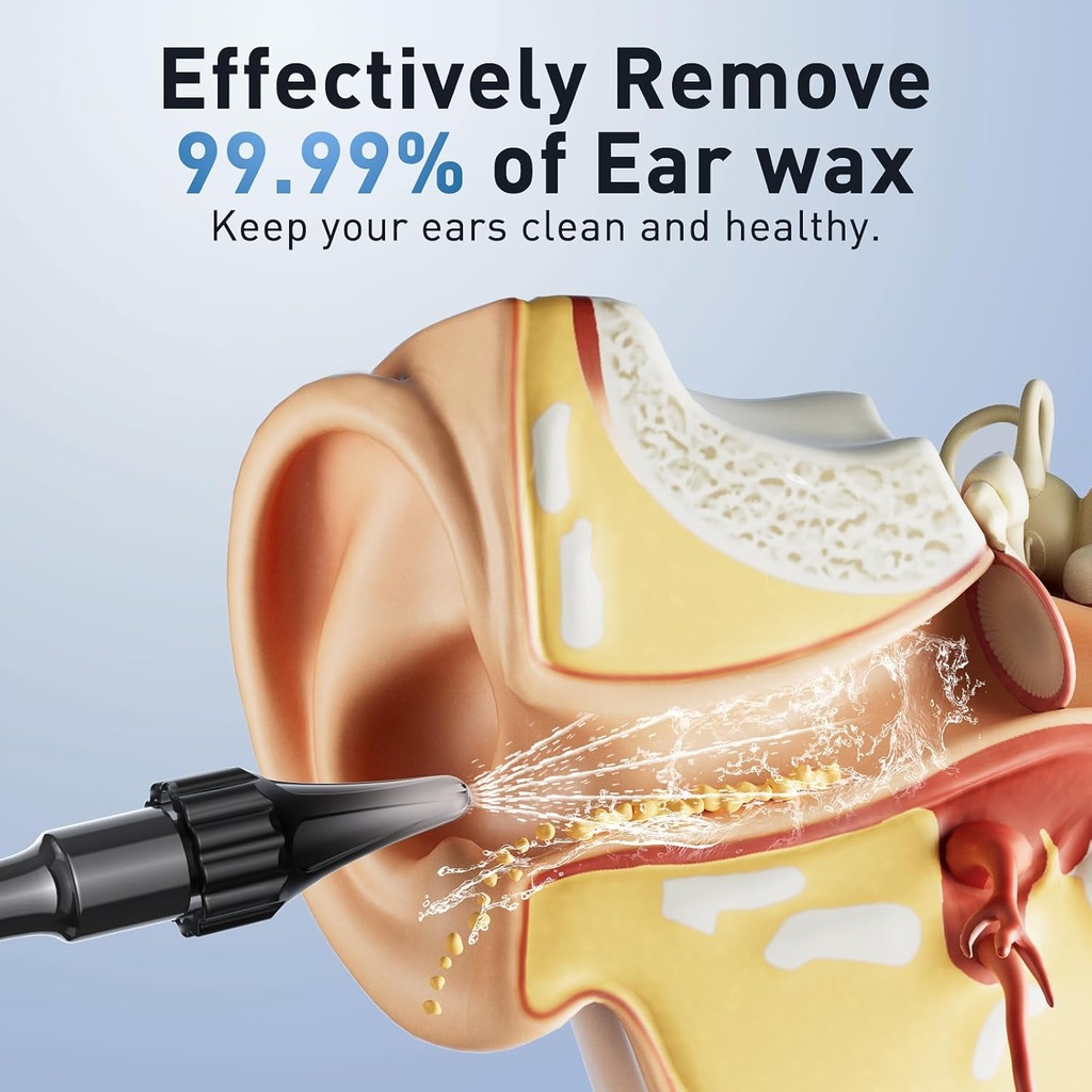 ear-wax-removal---electric-ear-irrigatio-3.jpg