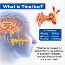 acupeace-tinnitus-relief-device-auricalm-3.jpg