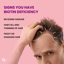 carbamide-forte-biotin-tablets-for-hair--61IQ+SlX+rL.jpg
