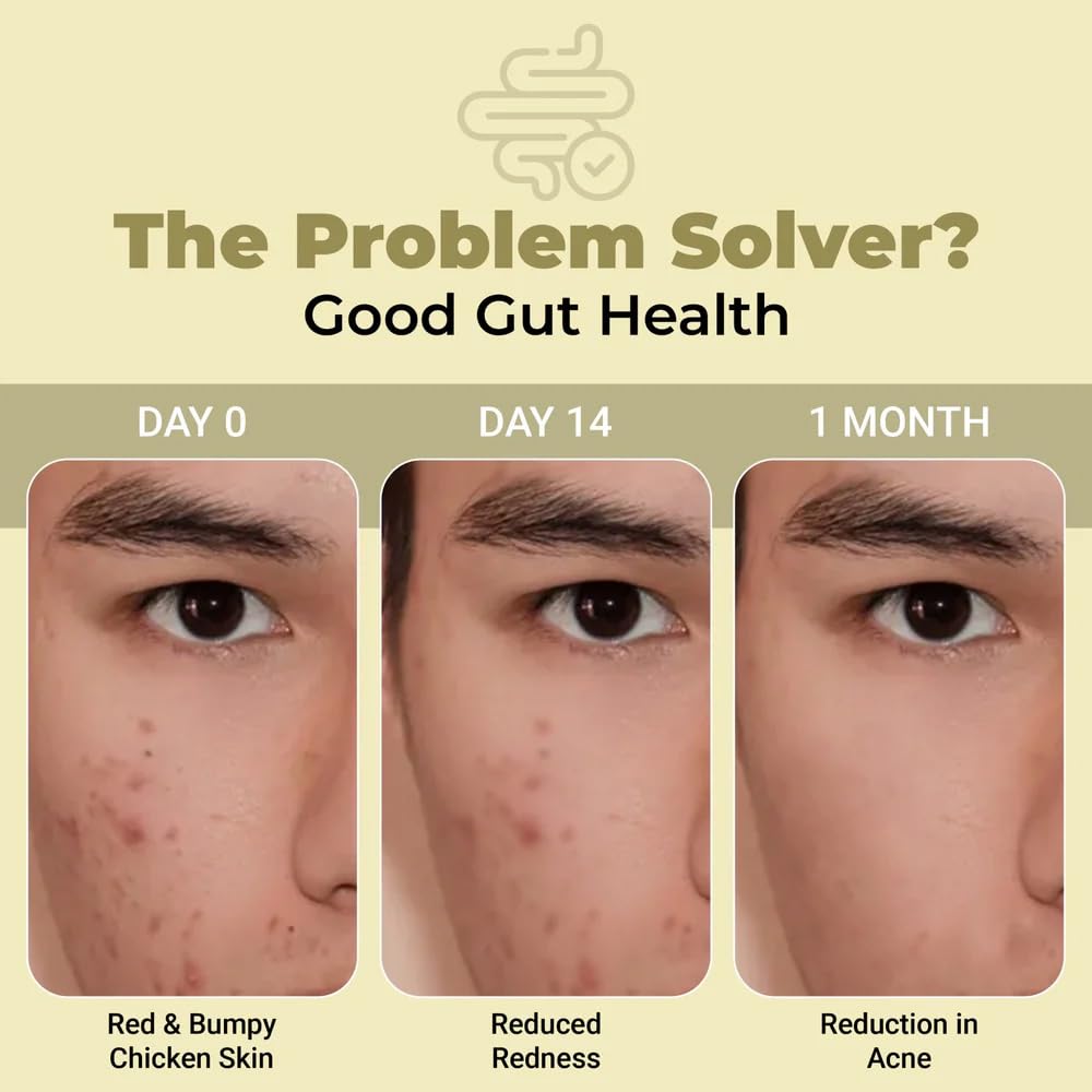 cureveda-skingut-pre-probiotic-powder-fo-619aEeGUL3L.jpg