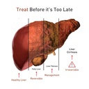 for-your-liver-cleanse-detox-repair-orga-71ML+sAOrSL.jpg