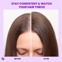 carbamide-forte-biotin-tablets-for-hair--81AGrR7w7oL.jpg