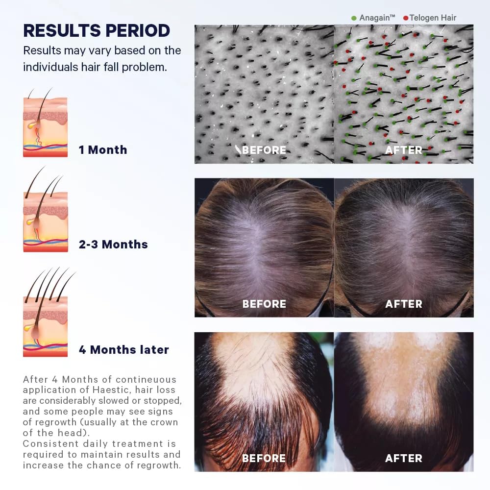 hairful-biotin-supplement-tablet-for-hel-71ZSWOewIPL.jpg