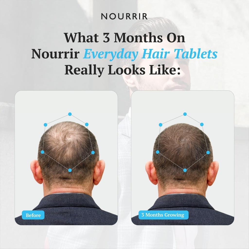 men-s-hair-growth-tablets-biotin-dht-blo-810Hy+XYuTL.jpg