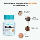 myupchar-biotin-supplement-with-vitamin--71hwAA7w5uL.jpg