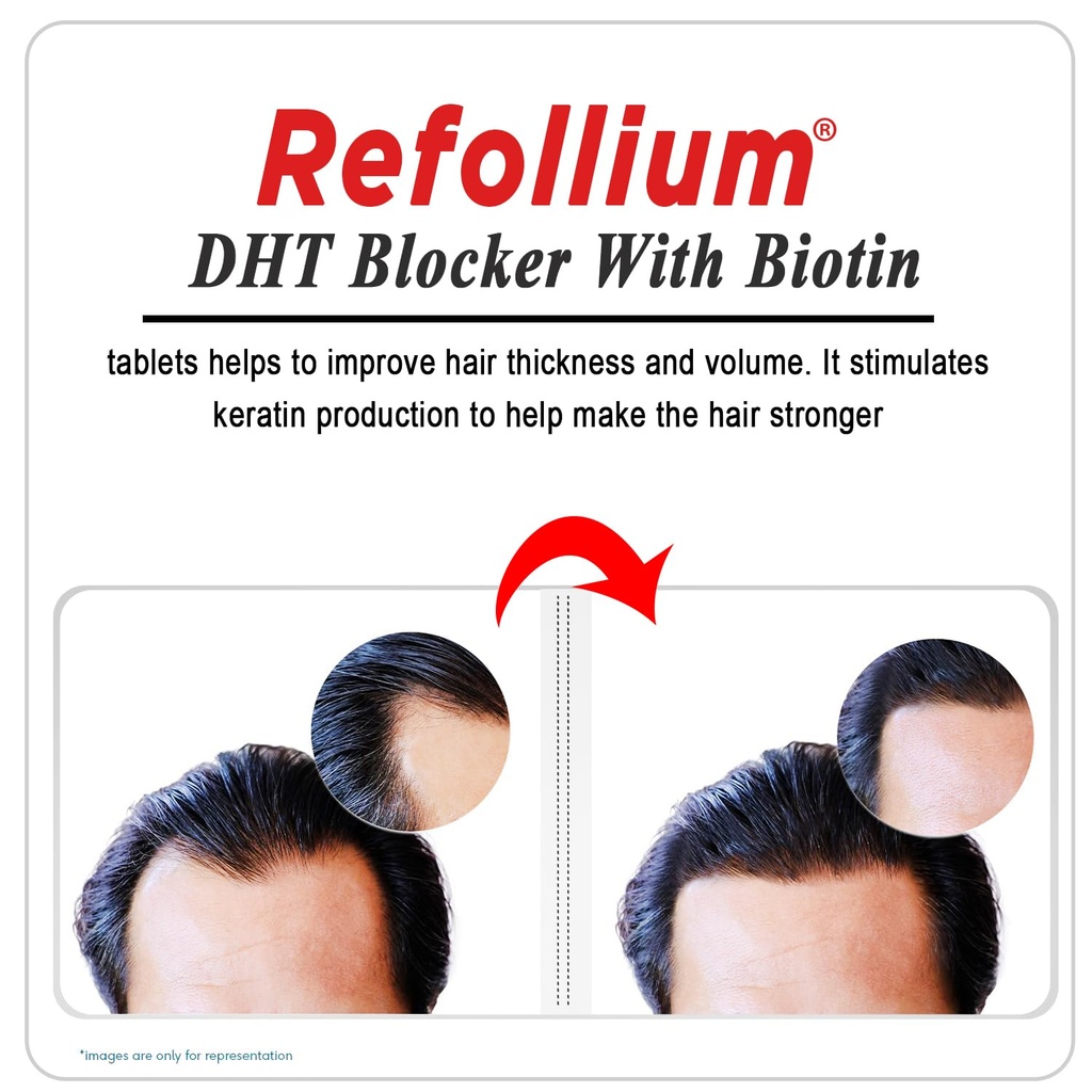 dht-blocker-with-biotin-helps-reduce-hai-71MpPIayP+L.jpg