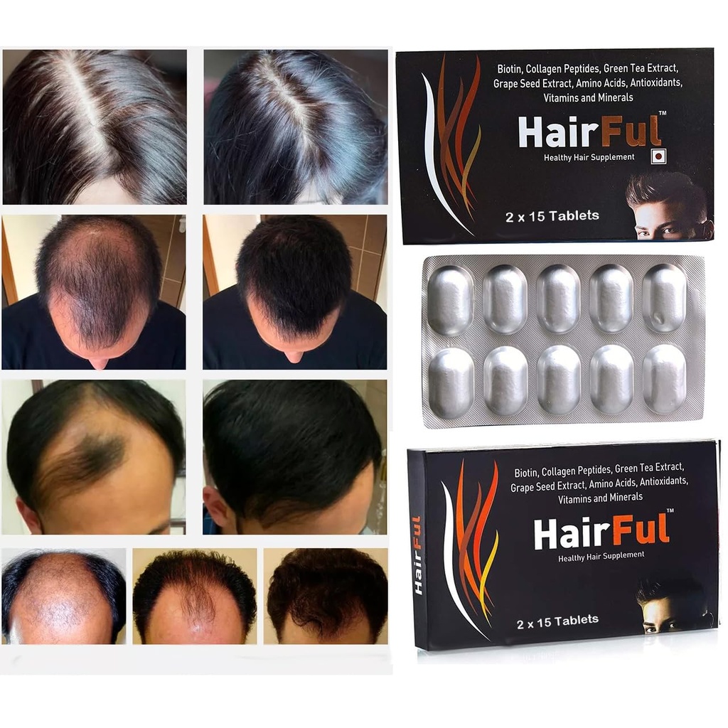 hairful-biotin-hair-tablets-for-stronger-716jhUpjHIL.jpg