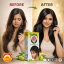 i-action-kesh-amrit-ganjnashk-oil-i-lega-81VqV8cJk7L.jpg