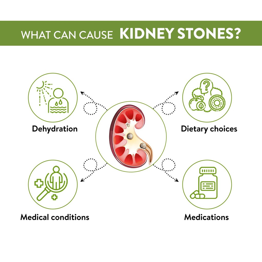 stonex-helps-to-detox-kidney-cleanse-pur-61Alds3kWlL.jpg