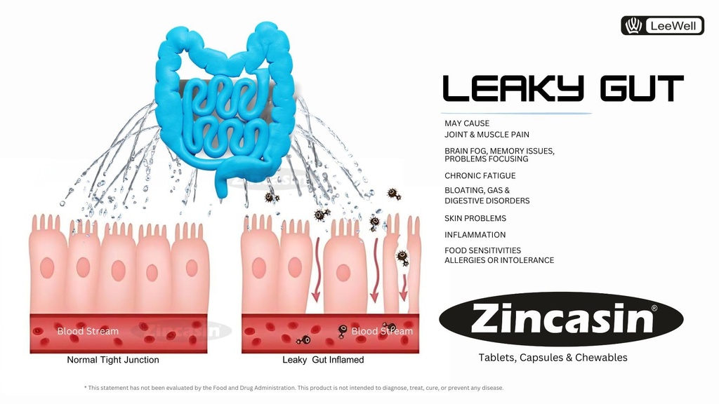 zincasin-plus-leewell-gastric-health-sup-71aDI+k-xbL.jpg