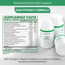 eczema-supplements---formulated-dyshidro-2.jpg