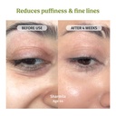 vilvah-under-eye-cream-reduces-dark-circ-61UWx0d7mcL.jpg