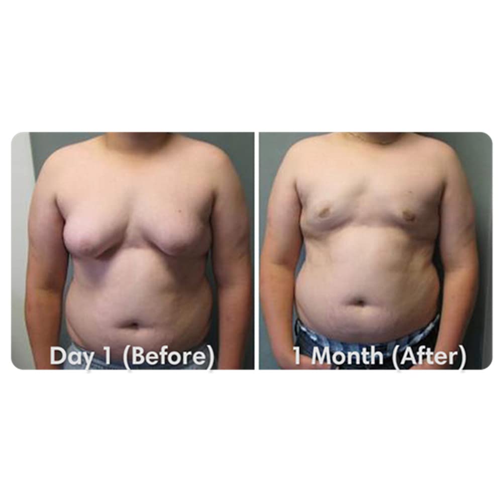 ikasus-powerful-gynecomastia-tightening--4.jpg