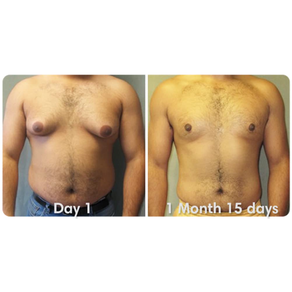 ikasus-powerful-gynecomastia-tightening--5.jpg