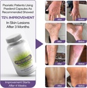 psoriasis-support-for-skin-120-herbal-ca-6.jpg