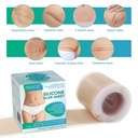silicone-scar-sheets-silicone-scar-tape--6.jpg