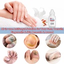 toenail-fungus-treatment-extra-strength--4.jpg