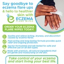eczema-flare-wipes---all-natural-fast-ac-2.jpg