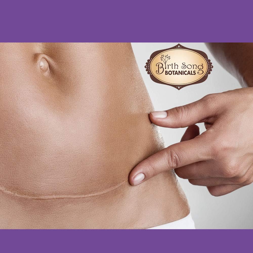 birth-song-botanicals-organic-cesarean-r-5.jpg