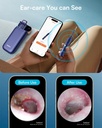 bebird-flexible-ear-wax-removal-tool-cam-5.jpg