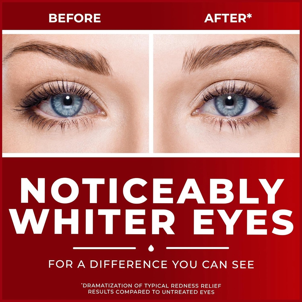 clear-eyes-maximum-redness-relief-eye-dr-4.jpg