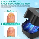 nail-fungus-laser-treatment-led-light-de-5.jpg