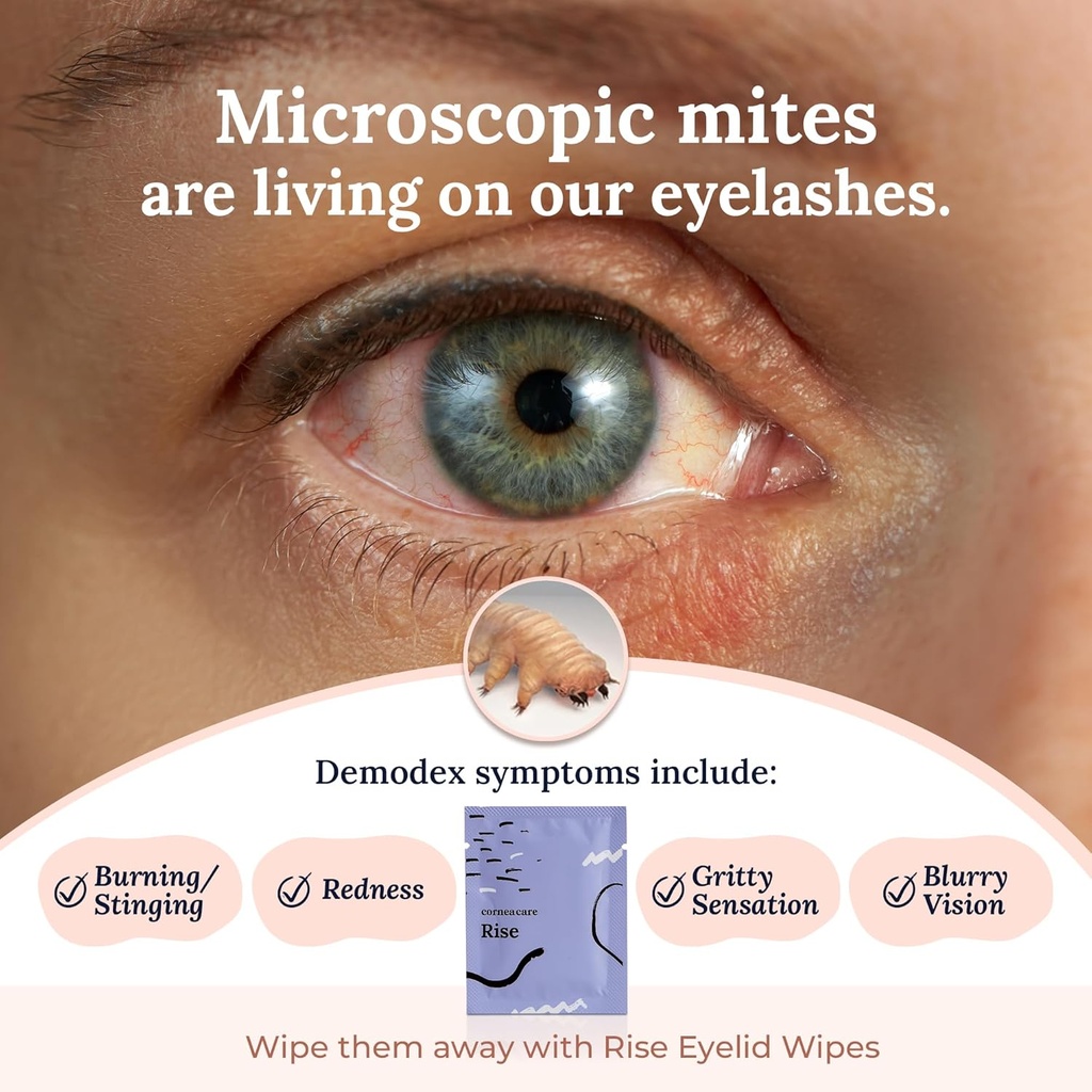corneacare-rise-eyelid-wipes-eye-wipes-f-3.jpg
