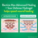 bactine-max-advanced-healing-hydrogel-wi-3.jpg