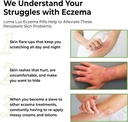 loma-lux-eczema-pills-natural-eczema-tre-4.jpg