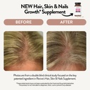 healthy-skin-hair-nails-supplement-by-re-2.jpg