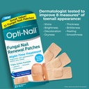 opti-nail-fungal-nail-renewal-patches----4.jpg