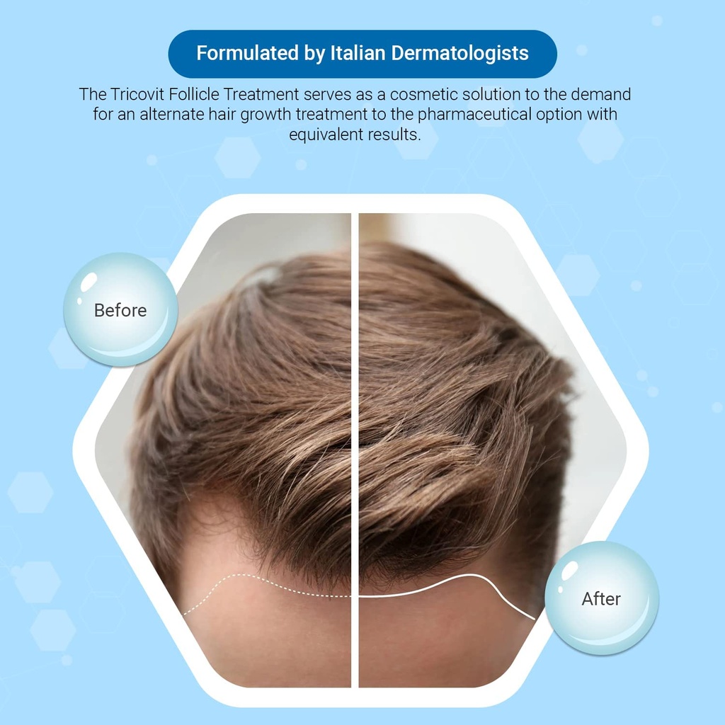 tricovit-pro-hair-growth-supplement---ha-5.jpg