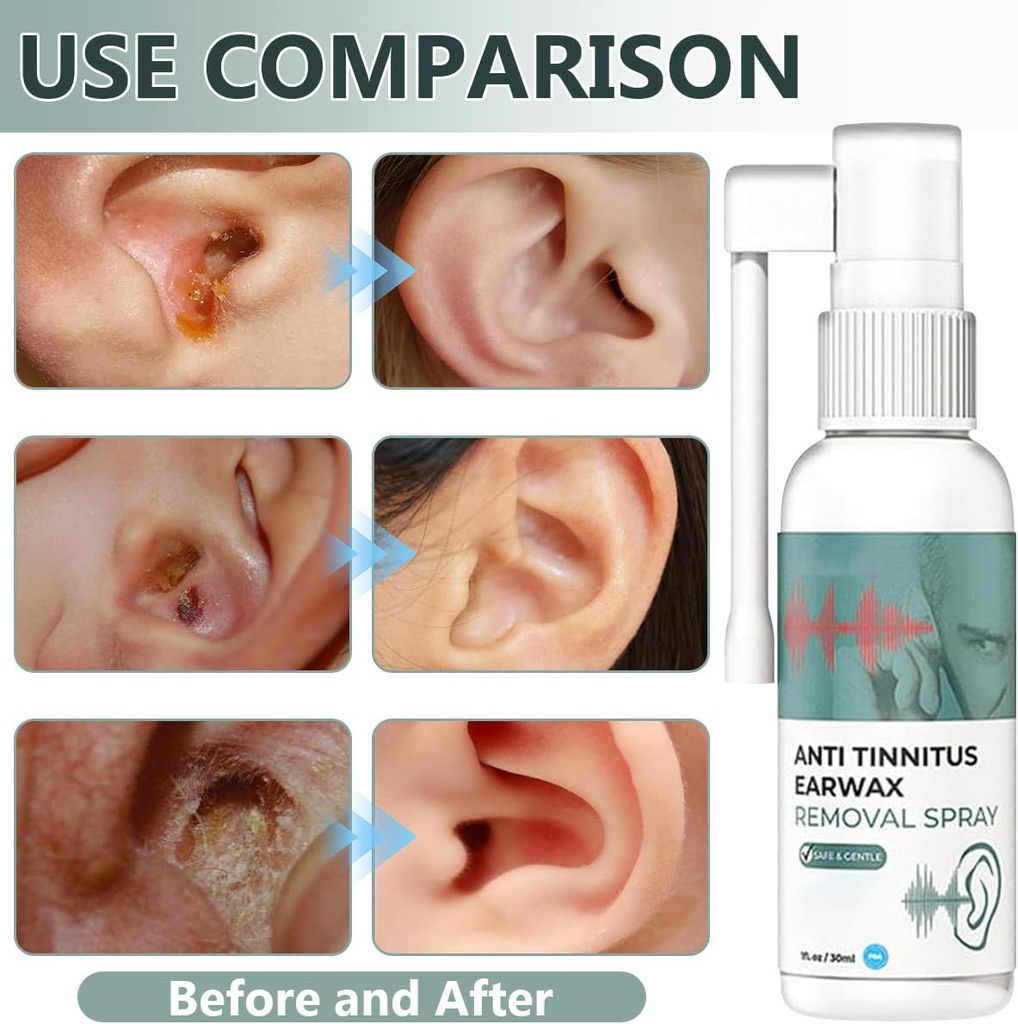 hearing-restoration-spray-anti-tinnitus--3.jpg