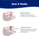 zquiet-anti-snoring-mouthpiece-solution--2.jpg