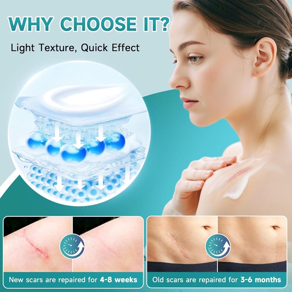 advanced-scar-cream-silicone-gel-for-sca-5.jpg