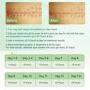 silicone-scar-sheets-clear-silicon-gel-s-5.jpg