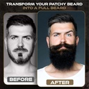 beardilizer-beard-strong-beard-oil-for-m-3.jpg