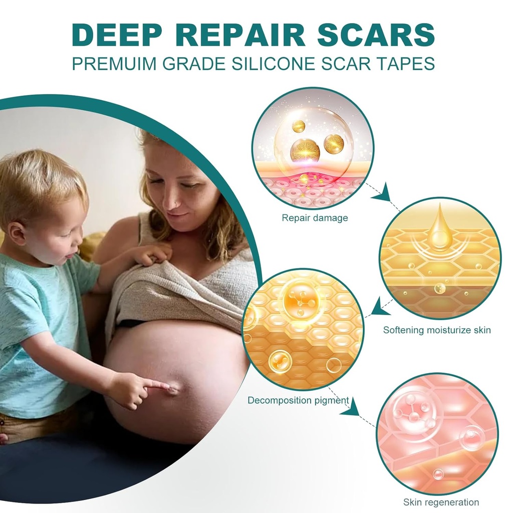 silicone-scar-sheets-16x-79-roll-2m-sili-3.jpg