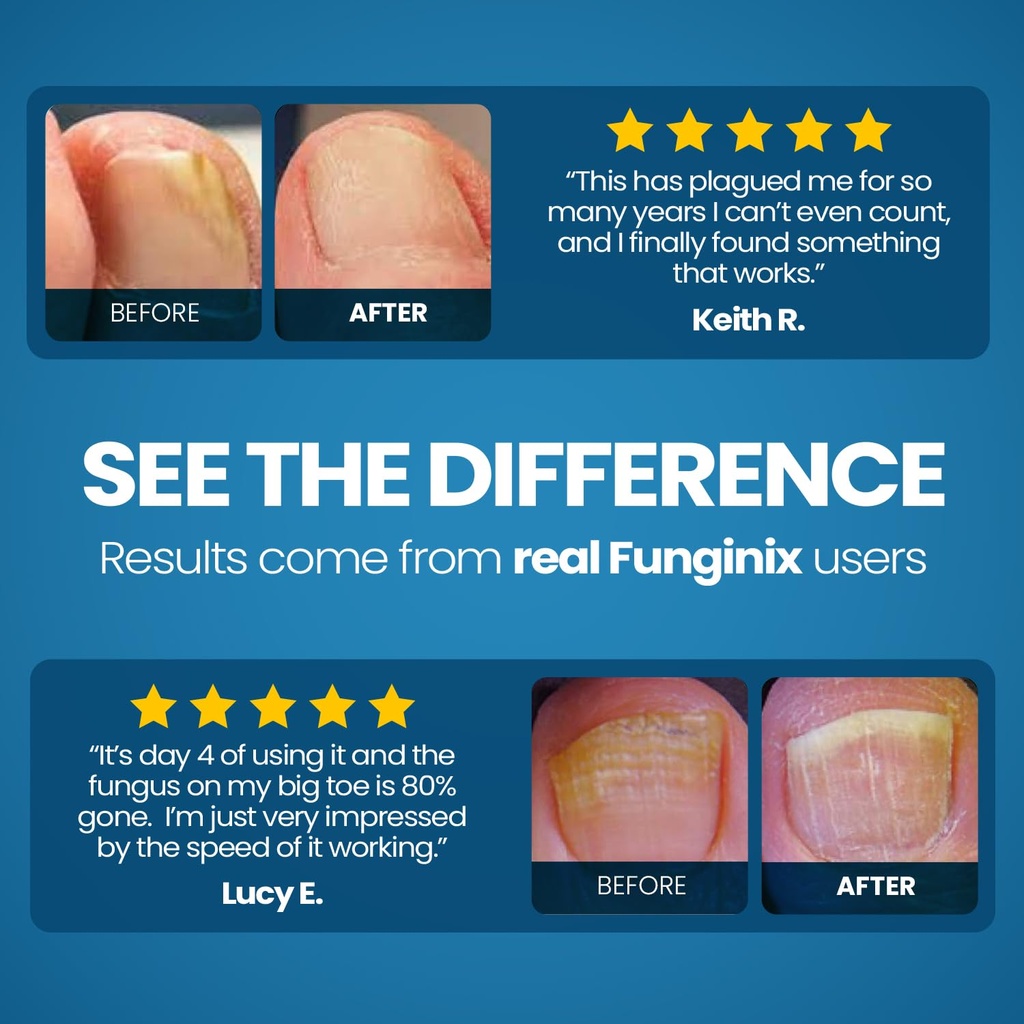 funginix-toenail-fungus-treatment-extra--6.jpg