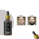 classic-beard-growth-oil---may-boost-you-2.jpg