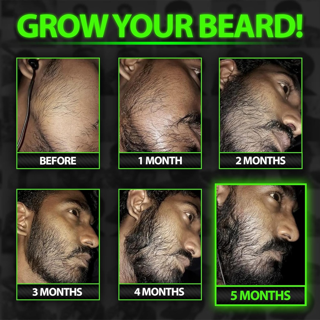 beard-growth-kit-wgrow-beard-oil-for-men-3.jpg