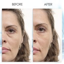 puffy-eye-gel-instant-results-naturally--2.jpg
