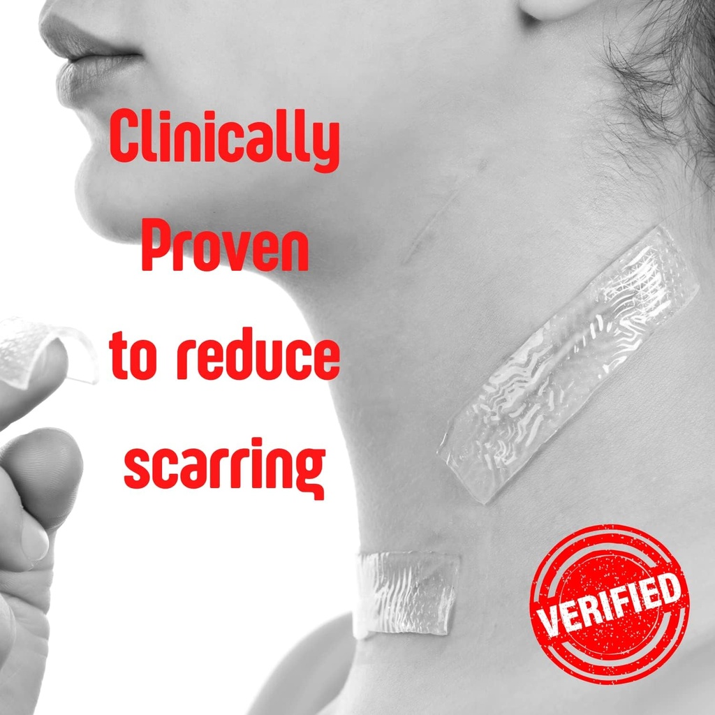 SilverSeal Burn and Wound Dressing, Hydrogel Pads with X-Static Silver, Soothing, Moist & Protective for Burns, Cuts & Wounds, 2" x 3" Sterile Dressings, 6 Count 6